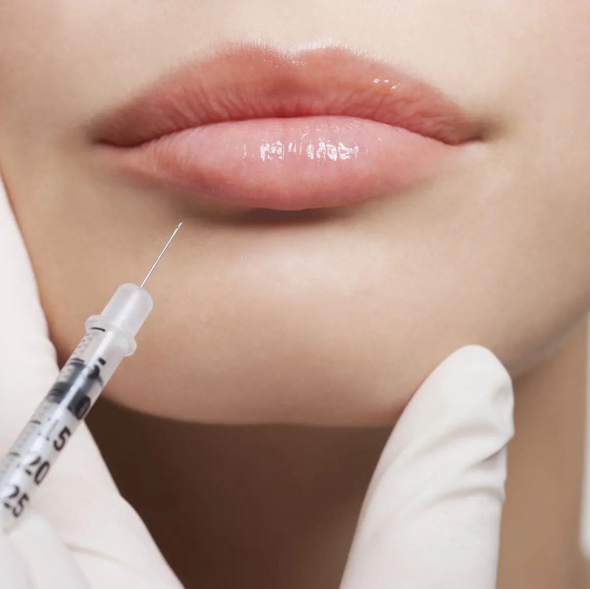 Dermal filler treatments available from Lashes, Brows & Aesthetics in Sutton Bridge