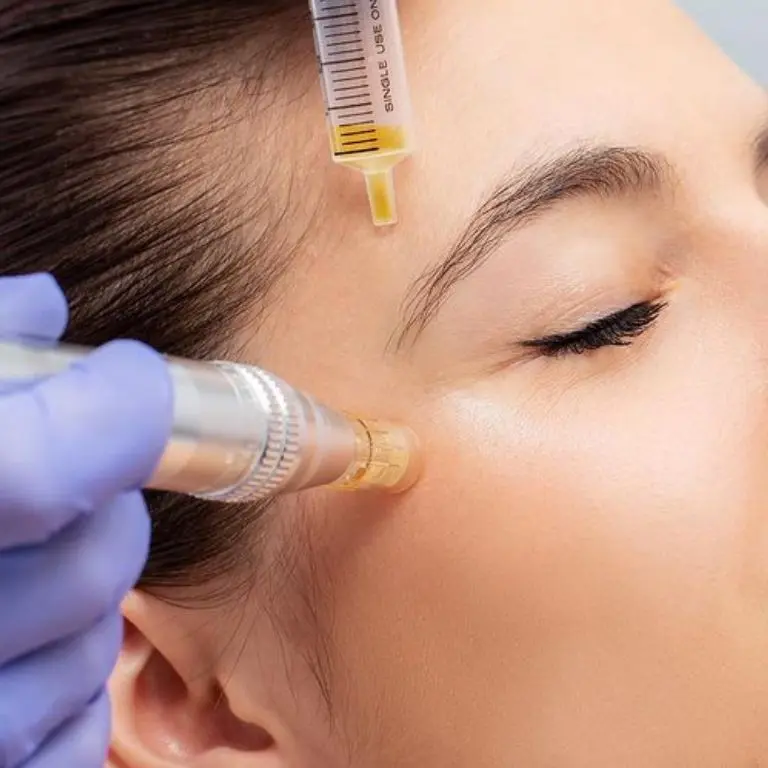 Microneedling service from Lashes Brows and Aesthetics
