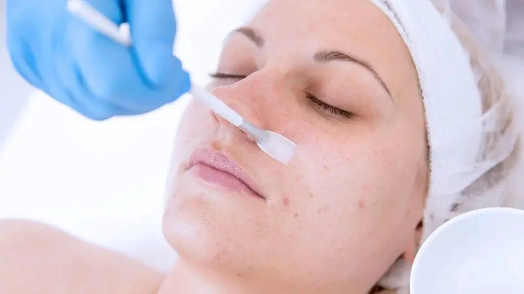 Skin Peel service from Lashes Brows and Aesthetics